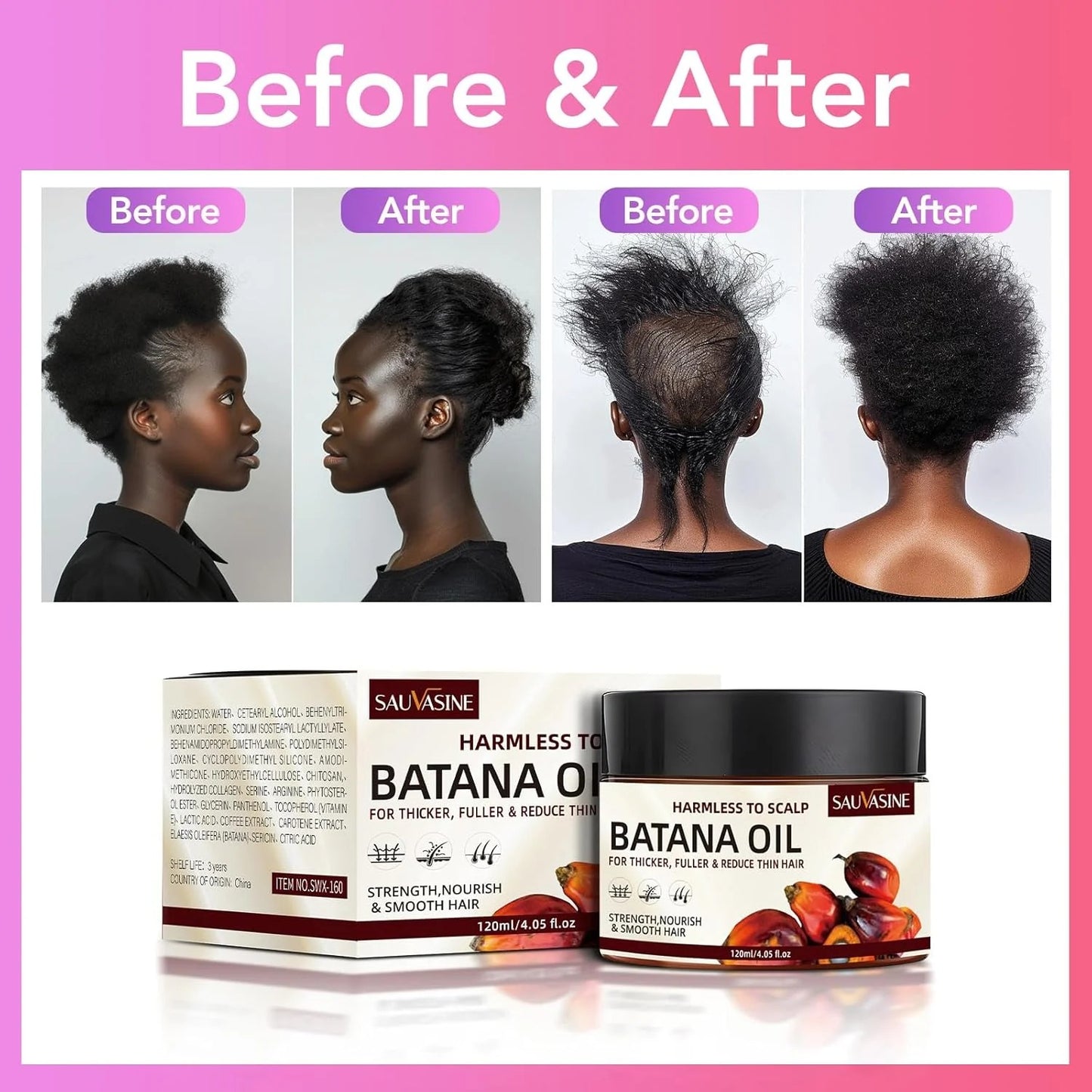 SAUVASINE Batana Hair Oil for Nourished & Fuller-Looking Hair