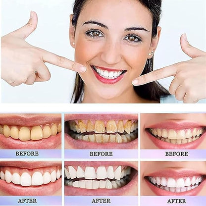 Oralhoe Nicotinamide Dazzle White Toothpaste for Freshness & Whitening