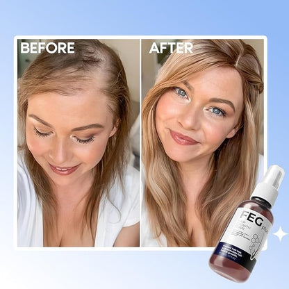 FEG Plus Hair Growth & Scalp Care Spray