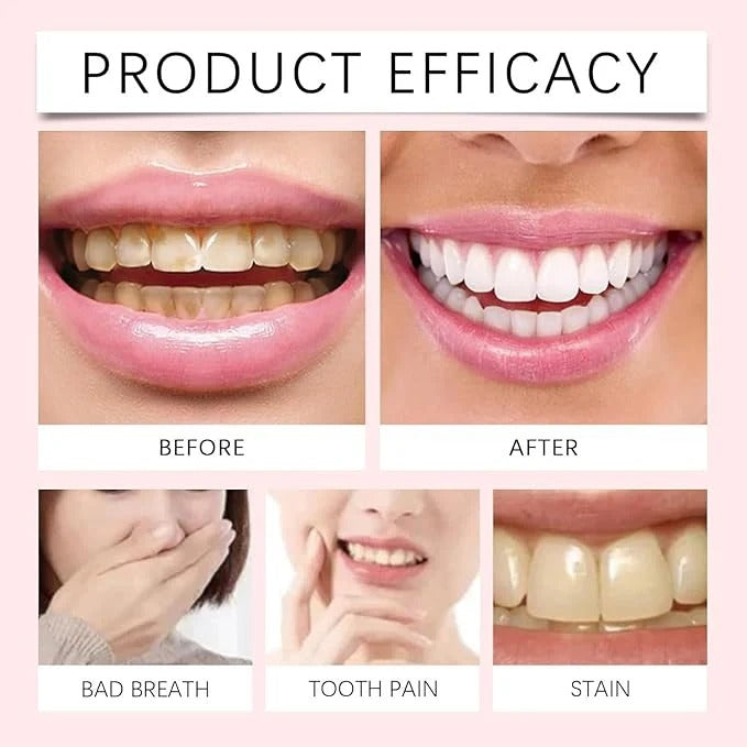Oralhoe Nicotinamide Dazzle White Toothpaste for Freshness & Whitening