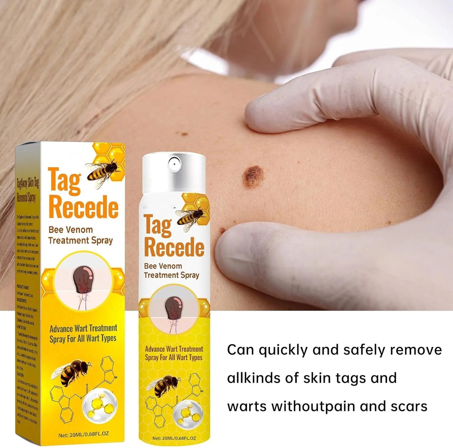 Tag Recede Bee Venom Wart & Skin Tag Repair Spray