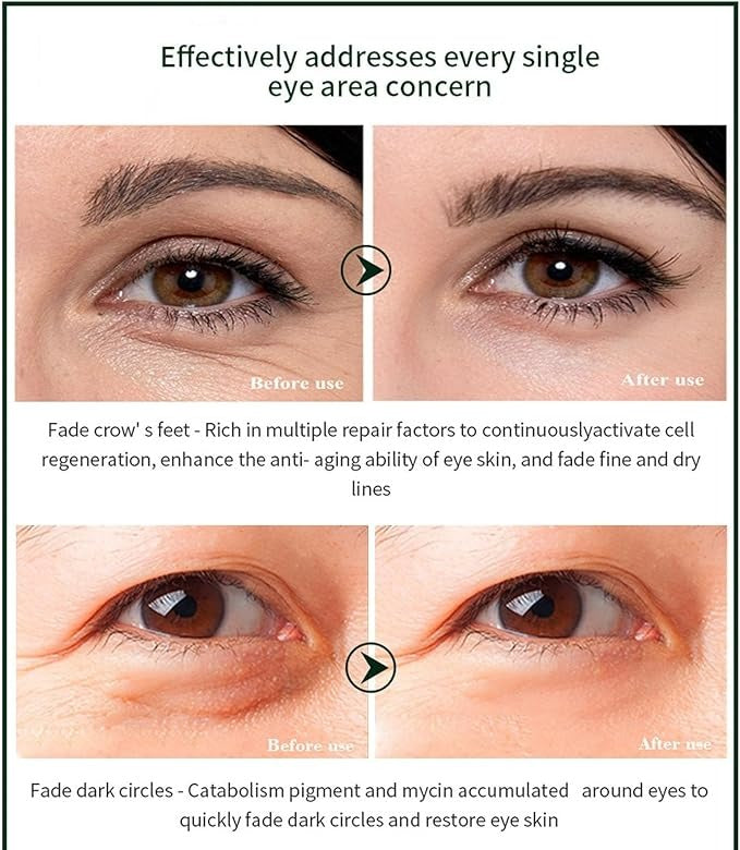 Time Eraser Eye Essence Oil for Under-Eye Care