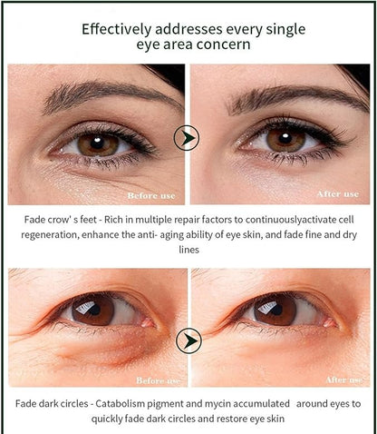 Time Eraser Eye Essence Oil for Under-Eye Care